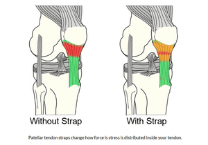 Patella Knee Strap, 1 Pair